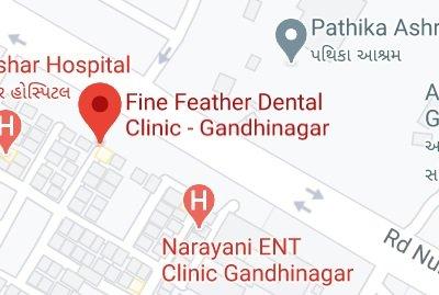 Fine Feather Dental store location map