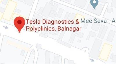 Tesla Diagnostics store location map