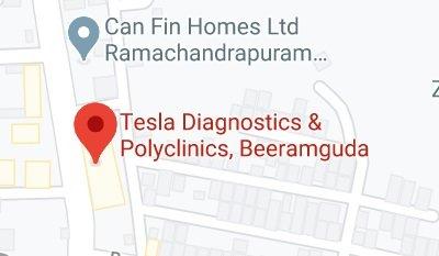 Tesla Diagnostics store location map