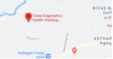 Tesla Diagnostics store location map
