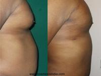 Cosmesis India offers