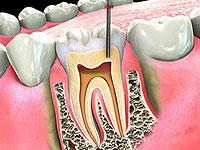 Pearl Dental Clinic offers