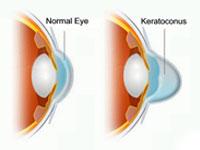Kenia Eye Hospital offers