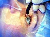 Dr Pattnaiks Laser Eye Institute offers