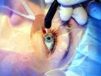 Aditya Jyot Eye Hospital offers