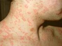 Naina Homeo Clinic offers