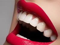 Smile On Dental Clinic offers