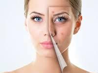 Skin Renew Skin Clinic offers