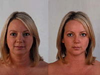 New Look Laser Clinic offers