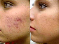 New Look Laser Clinic offers