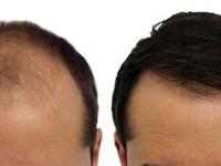 Classy Grafts offers