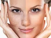 Laser Skin Clinic offers