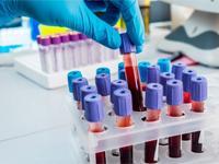 Lucid Medical Diagnostics offers