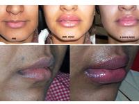 Cosmesis India 0 sales India