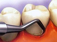 Pearl Dental Clinic 0 sales India