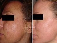 Spring Med Spa 0 sales India