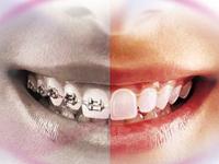 Celebrity Smiles 0 sales India