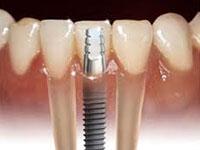 32 Smiles Dental Clinic 0 sales India