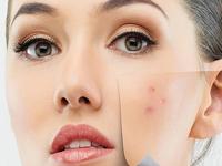 Lotlite Beauty Salon 0 sales India