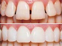 Toothwise Dental Hospital 0 sales India