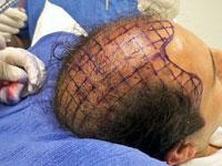 Revive Aesthetic Clinic 0 sales India