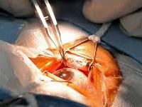 Centre for Vision and Eye Surgery 0 sales India