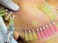 Hairline International Hair Clinic 0 sales India