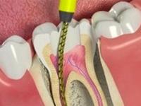 Smile Dental Clinic 0 sales India