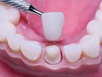 Vijay Dental Clinic 0 sales India