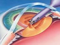 Win Vision Eye Hospital 0 sales India