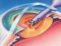 Dr Gadgil Eye Clinic Lasik Centre 0 sales India