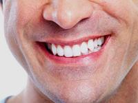 Fine Feather Dental 0 sales India