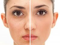 Amrit Laser and Cosmetic Surgery Clinic 0 sales India