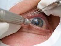 Sunetra Eye Centre 0 sales India