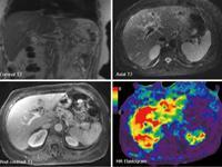 Lucid Medical Diagnostics 0 sales India