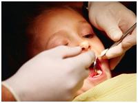 VCare32 Dental Clinic coupons