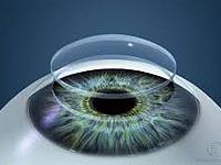 New Vision Laser Centers coupons