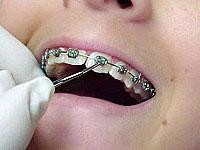 Pearl Dental Clinic coupons