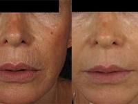 Spring Med Spa coupons