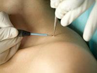 Revive Aesthetic Clinic coupons