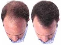 Origin Advanced Anti Aging and Slimming Clinic coupons