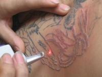 Dr Guri Skin Clinic coupons