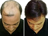 Feliz Health Care coupons