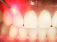 Brij Dental Clinic coupons