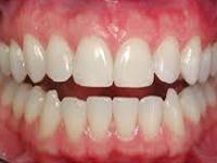 Grace Dental Clinic coupons