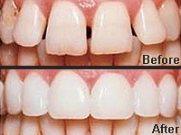 Dental Cosmetics & Implant Centre offers
