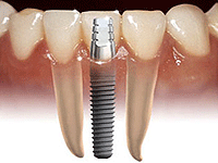 Dental Cosmetics & Implant Centre 0 sales India