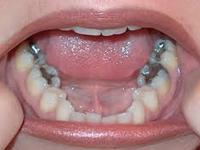 Oral Care 0 sales India