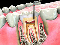 Dental Cosmetics & Implant Centre coupons