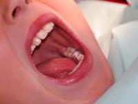 Oral Care coupons